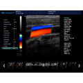 Máquina acessível portátil do ultra-som do eco de Doppler da cor 2D para a venda